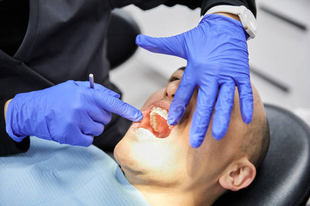 Best Broken or Cracked Tooth Emergency Dentist in Indian Springs, GA